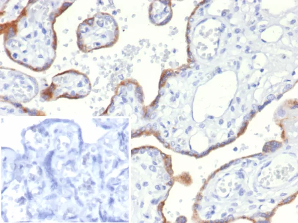 Formalin-fixed, paraffin-embedded human placenta stained with S100A2 Mouse Monoclonal Antibody (S100A2/6925). Inset: PBS instead of primary antibody; secondary only negative control.