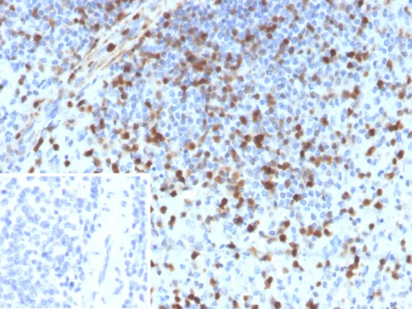 Formalin-fixed, paraffin-embedded human spleen stained with S100A4 Mouse Monoclonal Antibody (S100A4/6796). Inset: PBS instead of primary antibody; secondary only negative control.