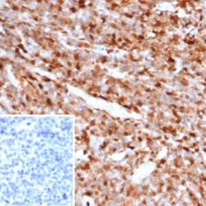 Formalin-fixed, paraffin-embedded human tonsil stained with S100A4 Mouse Monoclonal Antibody (S100A4/6799). Inset: PBS instead of primary antibody; secondary only negative control.