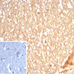 Formalin-fixed, paraffin-embedded human brain stained with S100A5 Mouse Monoclonal Antibody (S100A5/7472). Inset: PBS instead of primary antibody; secondary only negative control.