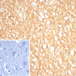 Formalin-fixed, paraffin-embedded human brain stained with S100A5 Mouse Monoclonal Antibody (S100A5/7474). Inset: PBS instead of primary antibody; secondary only negative control.