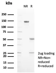 SDS-PAGE Analysis of Purified Calprotectin Mouse Monoclonal Antibody (S100A9/7550). Confirmation of Purity and Integrity of Antibody.