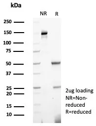 SDS-PAGE Analysis of Purified Calprotectin Mouse Monoclonal Antibody (S100A9/7551). Confirmation of Purity and Integrity of Antibody.