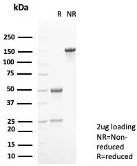 SDS-PAGE Analysis of Purified Calprotectin Mouse Monoclonal Antibody (S100A9/7552). Confirmation of Purity and Integrity of Antibody.