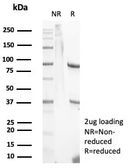 SDS-PAGE Analysis of Purified Calprotectin Mouse Monoclonal Antibody (S100A9/7553). Confirmation of Purity and Integrity of Antibody.