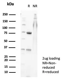 SDS-PAGE Analysis of Purified Calprotectin Mouse Monoclonal Antibody (S100A9/7547). Confirmation of Purity and Integrity of Antibody.