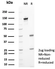 SDS-PAGE Analysis of Purified Calprotectin Mouse Monoclonal Antibody (S100A9/7548). Confirmation of Purity and Integrity of Antibody.