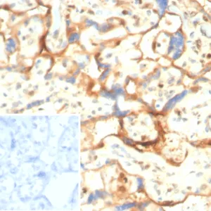 Formalin-fixed, paraffin-embedded human placenta stained with S100A11 Mouse Monoclonal Antibody (S100A11/7393). Inset: PBS instead of primary antibody; secondary only negative control.