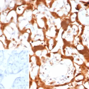Formalin-fixed, paraffin-embedded human placenta stained with S100A11 Mouse Monoclonal Antibody (S100A11/7394). Inset: PBS instead of primary antibody; secondary only negative control.