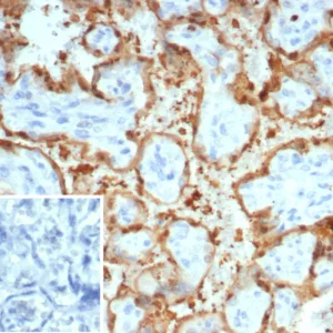 Formalin-fixed, paraffin-embedded human placenta stained with S100A12 Mouse Monoclonal Antibody (S100A12/4514). Inset: PBS instead of primary antibody; secondary only negative control.