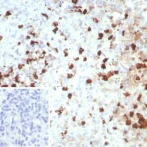 Formalin-fixed, paraffin-embedded human spleen stained with S100A12 Recombinant Rabbit Monoclonal Antibody (S100A12/8952R). Inset: PBS instead of primary antibody; secondary only negative control.