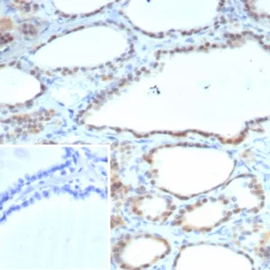 Formalin-fixed, paraffin-embedded human thyroid stained with S100A13 Mouse Monoclonal Antibody (S100A13/7484). Inset: PBS instead of primary antibody; secondary only negative control.
