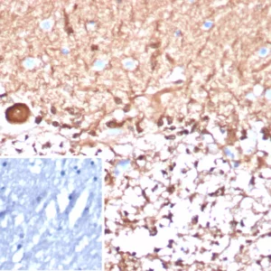 Formalin-fixed, paraffin-embedded human brain stained with S100B Mouse Monoclonal Antibody (S100B/4148). Inset: PBS instead of primary antibody; secondary only negative control.