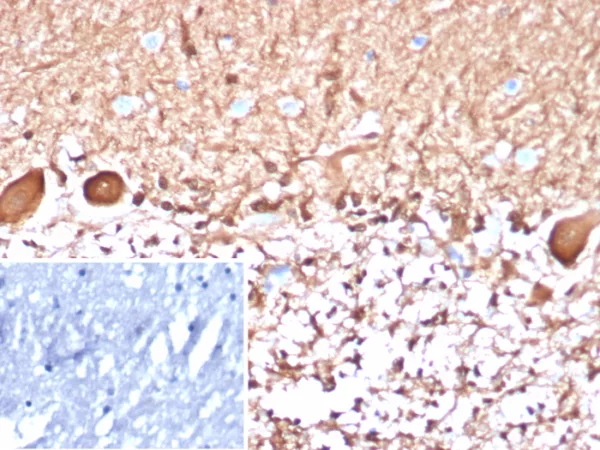 Formalin-fixed, paraffin-embedded human brain stained with S100B Mouse Monoclonal Antibody (S100B/4148). Inset: PBS instead of primary antibody; secondary only negative control.