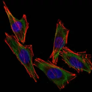 Confocal Immunofluorescent analysis of A2058 cells using CF488-labeled S100B Monoclonal Antibody (S100B/1012) (Green). F-actin filaments were labeled with Dylight 554 Phalloidin (red). DAPI was used to stain the cell nuclei (blue).
