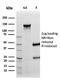 SDS-PAGE Analysis S100B Mouse Monoclonal Antibody (S100B/4152). Confirmation of Integrity and Purity of Antibody.