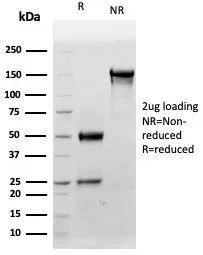 SDS-PAGE Analysis of Purified S100B Mouse Monoclonal Antibody (S100B/4159). Confirmation of Integrity and Purity of Antibody.