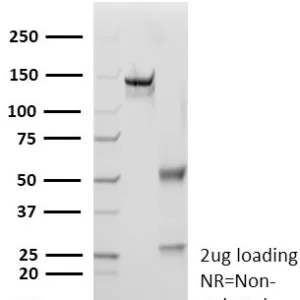 SDS-PAGE Analysis of Purified S100P Recombinant Mouse Monoclonal Antibody (rS100P/9254). Confirmation of Purity and Integrity of Antibody.