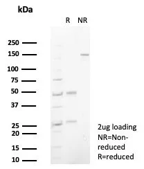 SDS-PAGE Analysis of Purified S100P Recombinant Mouse Monoclonal Antibody (S100P/7374). Confirmation of Purity and Integrity of Antibody.