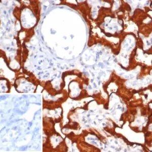 Formalin-fixed, paraffin-embedded human placenta stained with  S100P Recombinant Mouse Monoclonal Antibody (S100P/7375). 	Inset: PBS instead of primary antibody; secondary only negative control.