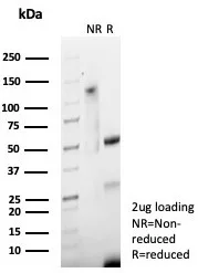 SDS-PAGE Analysis of Purified S100P Recombinant Rabbit Monoclonal Antibody (S100P/7978R). Confirmation of Purity and Integrity of Antibody.