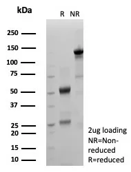 SDS-PAGE Analysis of Purified S100P Recombinant Rabbit Monoclonal Antibody (S100P/9135R). Confirmation of Purity and Integrity of Antibody.
