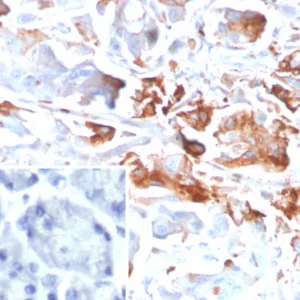 Formalin-fixed, paraffin-embedded human stomach stained with  CEACAM1 Mouse Monoclonal Antibody (CEACAM1/4840). Inset: PBS instead of primary antibody; secondary only negative control.