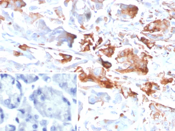 Formalin-fixed, paraffin-embedded human stomach stained with  CEACAM1 Mouse Monoclonal Antibody (CEACAM1/4840). Inset: PBS instead of primary antibody; secondary only negative control.