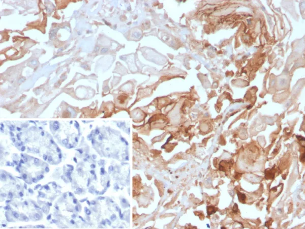 Formalin-fixed, paraffin-embedded human stomach stained with  CEACAM1 Mouse Monoclonal Antibody (CEACAM1/4843). Inset: PBS instead of primary antibody; secondary only negative control.