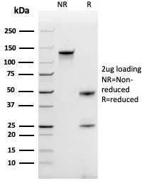 SDS-PAGE Analysis of Purified CCL18 Mouse Monoclonal Antibody (CCL18/3744). Confirmation of Purity and Integrity of Antibody.