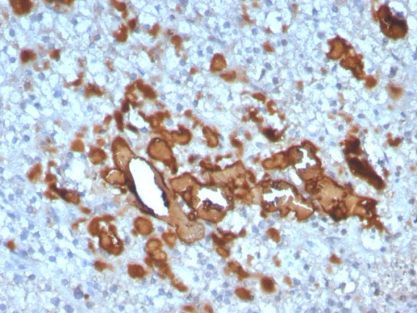 Formalin-fixed, paraffin-embedded human adrenal gland stained with CCL23 Mouse Monoclonal Antibody (CCL23/4034). HIER: Tris/EDTA, pH9.0, 45min. 2°: HRP-polymer, 30min. DAB, 5min