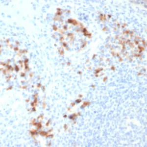 Formalin-fixed, paraffin-embedded human tonsil stained with CD138 Mouse Monoclonal Antibody (SDC1/7182). HIER: Tris/EDTA, pH9.0, 45min. 2°C: HRP-polymer, 30min. DAB, 5min.
