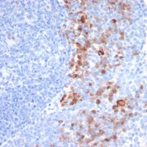 Formalin-fixed, paraffin-embedded human tonsil stained with CD138 Mouse Monoclonal Antibody (SDC1/7183). HIER: Tris/EDTA, pH9.0, 45min. 2°C: HRP-polymer, 30min. DAB, 5min.