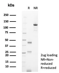SDS-PAGE Analysis of Purified CD138 Mouse Monoclonal Antibody (SDC1/7177). Confirmation of Purity and Integrity of Antibody.