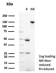 SDS-PAGE Analysis of Purified CD138 Mouse Monoclonal Antibody (SDC1/7178). Confirmation of Purity and Integrity of Antibody.