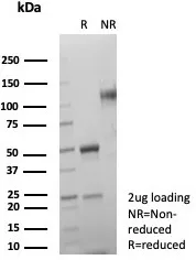 SDS-PAGE Analysis of Purified SDHA Mouse Monoclonal Antibody (SDHA/7491). Confirmation of Purity and Integrity of Antibody.