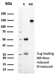 SDS-PAGE Analysis of Purified SDHA Mouse Monoclonal Antibody (SDHA/7493). Confirmation of Purity and Integrity of Antibody.