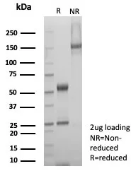 SDS-PAGE Analysis of Purified SDHA Mouse Monoclonal Antibody (SDHA/7495). Confirmation of Purity and Integrity of Antibody.