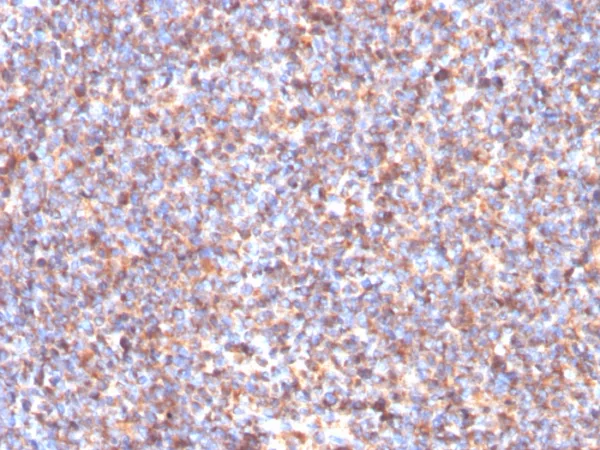 Formalin-fixed, paraffin-embedded human tonsil stained with SDHB Mouse Monoclonal Antibody (SDHB/3204). HIER: Tris/EDTA, pH9.0, 45min. 2°C: HRP-polymer, 30min. DAB, 5min.