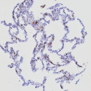 Formalin-fixed, paraffin-embedded human lung stained with CD162 Recombinant Rabbit Monoclonal Antibody (PSGL1/8135R).