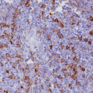 Formalin-fixed, paraffin-embedded human tonsil stained with CD162 Recombinant Rabbit Monoclonal Antibody (PSGL1/8192R). HIER: Tris/EDTA, pH9.0, 45min. 2: HRP-polymer, 30min. DAB, 5min.