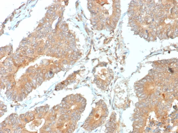 Formalin-fixed, paraffin-embedded human prostate stained with NECAB1 Mouse Monoclonal Antibody (NECAB1/7676). HIER: Tris/EDTA, pH9.0, 45min. 2°C: HRP-polymer, 30min. DAB, 5min.