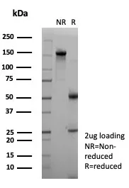 SDS-PAGE Analysis of Purified NECAB1 Mouse Monoclonal Antibody (NECAB1/7677). Confirmation of Purity and Integrity of Antibody.
