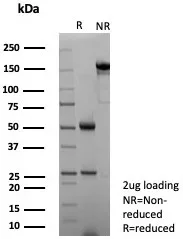 SDS-PAGE Analysis of Purified NECAB1 Mouse Monoclonal Antibody (NECAB1/7680). Confirmation of Purity and Integrity of Antibody.