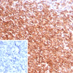 Formalin-fixed, paraffin-embedded human tonsil stained with CXCR5  Recombinant Rabbit Monoclonal Antibody (CXCR5/8146R). Inset: PBS instead of primary antibody; secondary only negative control.