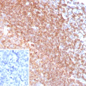 Formalin-fixed, paraffin-embedded human tonsil stained with Topo IIa Recombinant Rabbit Monoclonal Antibody (CXCR5/8279R). Inset: PBS instead of primary antibody; secondary only negative control.