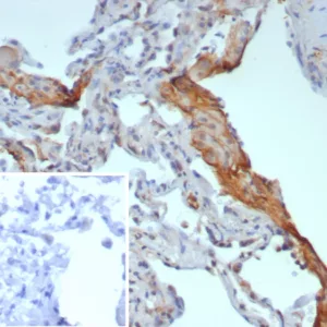 Formalin-fixed, paraffin-embedded human lung stained with Surfactant Protein D Recombinant Mouse Monoclonal (rSFTPD/8064). Inset: PBS instead of primary antibody; secondary only negative control.