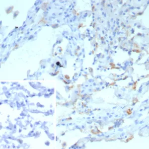 Formalin-fixed, paraffin-embedded human lung stained with Surfactant Protein D Recombinant Mouse Monoclonal (rSFTPD/8065). Inset: PBS instead of primary antibody; secondary only negative control.
