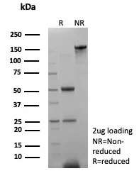 SDS-PAGE Analysis of Purified SHBG Mouse Monoclonal Antibody (SHBG/8175). Confirmation of Integrity and Purity of Antibody.