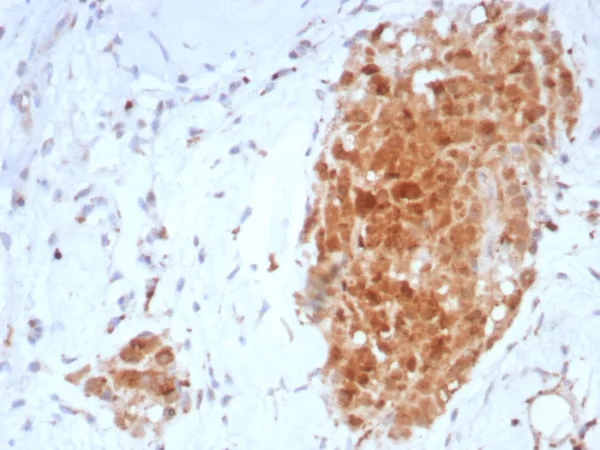 Formalin-fixed, paraffin-embedded human testis stained with  SHBG Mouse Monoclonal Antibody (SHBG/8925). HIER: Tris/EDTA, pH9.0, 45min. 2°C: HRP-polymer, 30min. DAB, 5min.